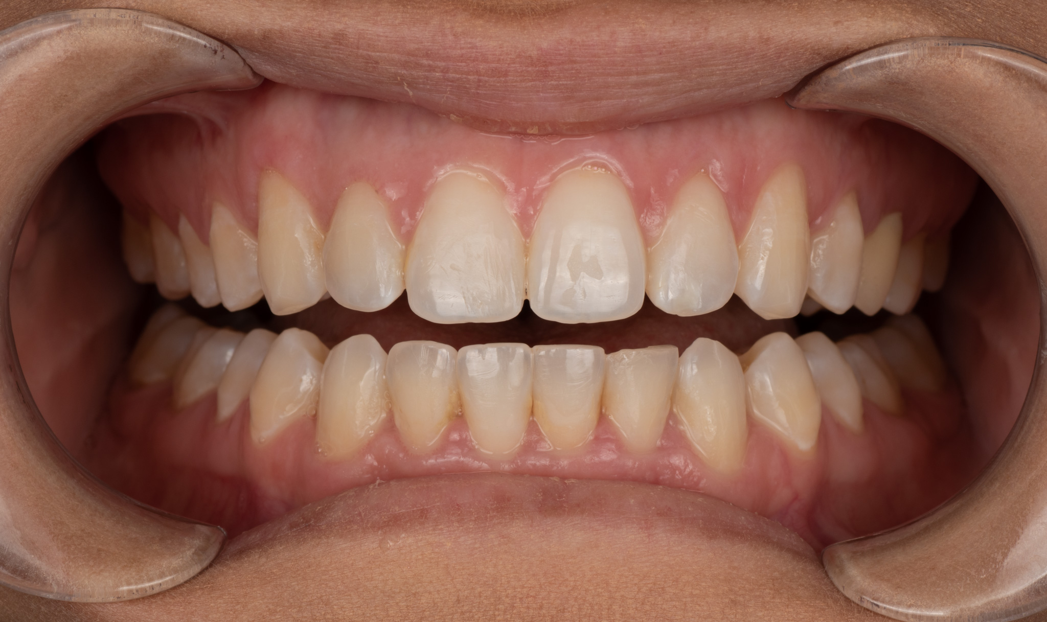 Jacksonville, FL Dentist JAX Dental Studio